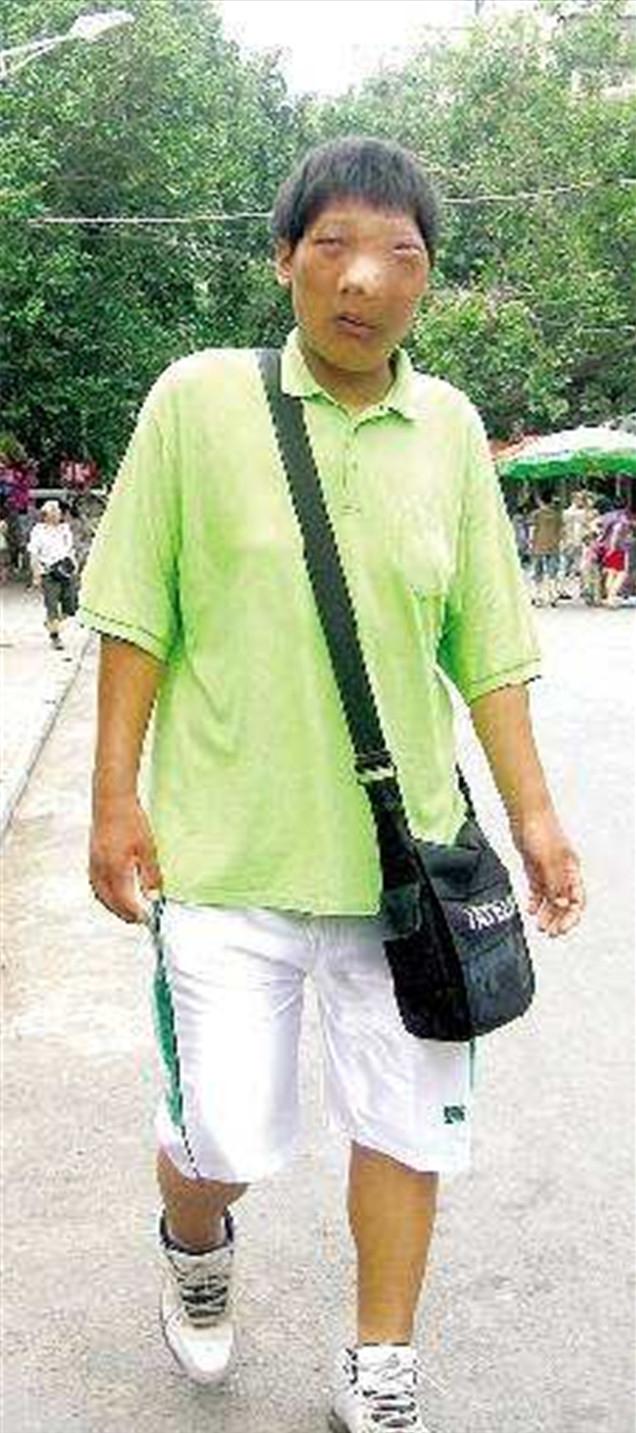 2013年，杨超凡因长相吓人求职受挫，在街头“卖丑”