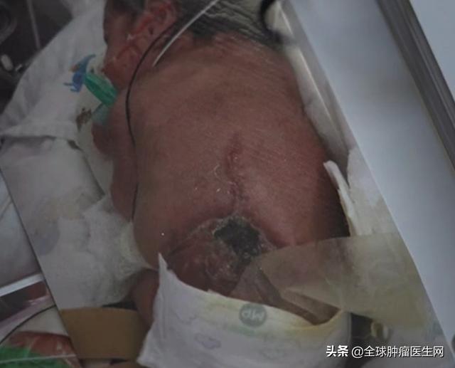 淚目！還未出生就確診癌癥，“傳奇”藥物讓最小的戰士擊敗腫瘤