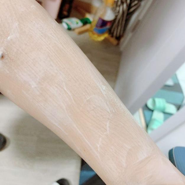 鸡皮肤怎样才能变好