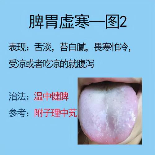 脾虚有四类，你要分清楚，对症养脾