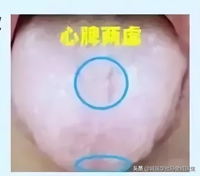 常用调理脾胃的中成药应用大全，不下十几种，看看怎么区分？