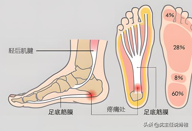 脚后跟痛怎么办