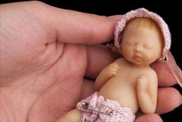 怀孕不到6个月的早产婴儿，专家称最小婴儿违背医学规律