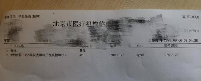29歲時確診肝癌，醫生預言只有半年生存期，現已延長8年至今