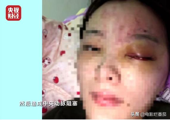 烟灰、脚气，为何会与知名酸菜挂钩？315晚会揭露的黑幕触目惊心