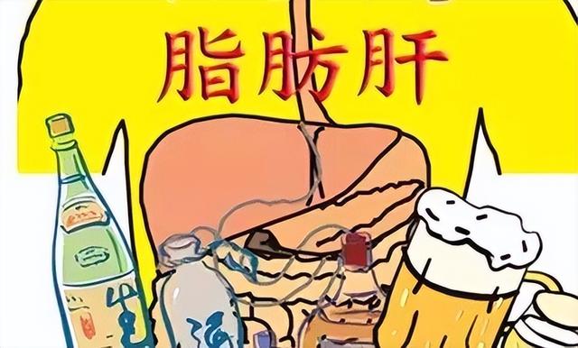 患有脂肪肝的人这4种食物要忌口，以免加重病情，需重视