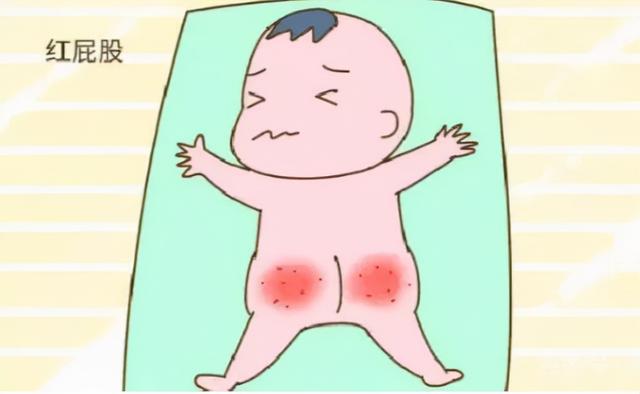 护臀膏与身体乳的区别