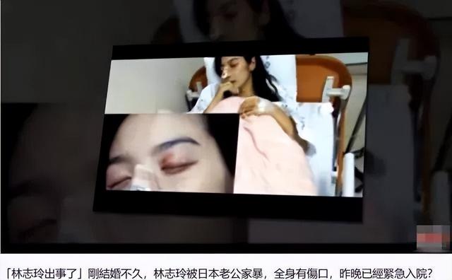 47岁林志玲产后首晒照！被日本老公家暴？错过言承旭的她幸福吗？