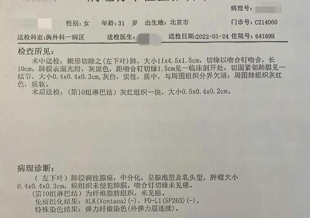 “在自己的强烈要求下做了手术”5mm磨玻璃肺结节已是浸润性腺癌