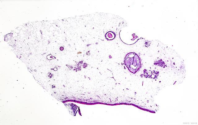 大便总感觉拉不干净、拉不完？可能是身体在告诉你这儿出问题了