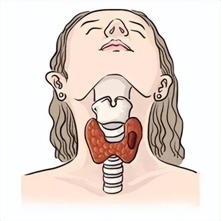 保护甲状腺丨关于甲状腺的那些事儿