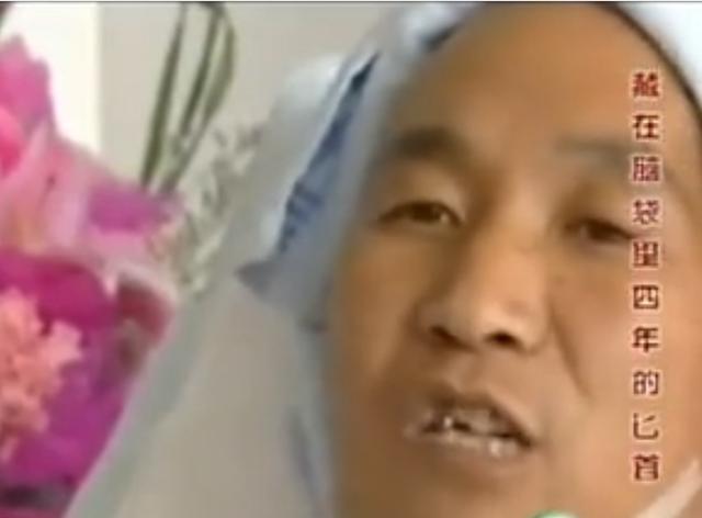11年云南男子头疼呕吐，身上散发臭味，检查发现脑中插着一把匕首
