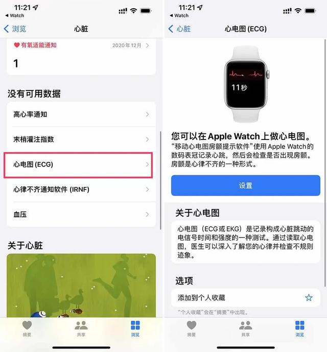 等了 3 年，国行版 Apple Watch 心电图功能终于来了