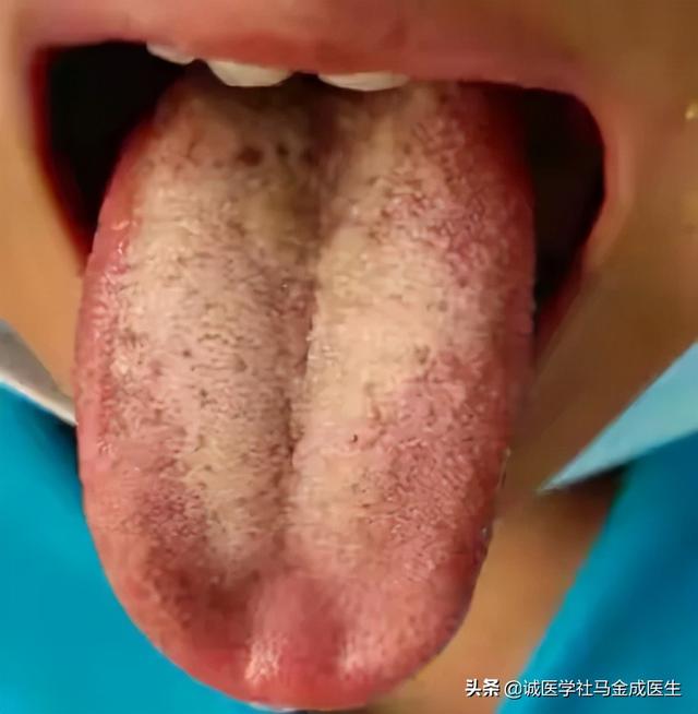 一吃凉的就胃痛？教你几个中成药，让你冷热酸甜，想吃就吃