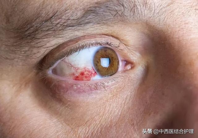 「穴位按摩养生」肝不好眼先知！一旦眼睛有2种“迹象”，很有可能是肝病
