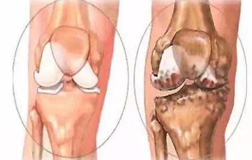 无需过度治疗，来看一下，5类“病”属于“老年病”