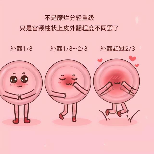 体检时查出这四种病，无需过度治疗，不要自己吓唬自己