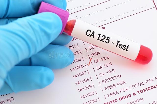 癌癥患者腫瘤標記物降低至正常人水平！懷疑醫院弄錯了，真相是？