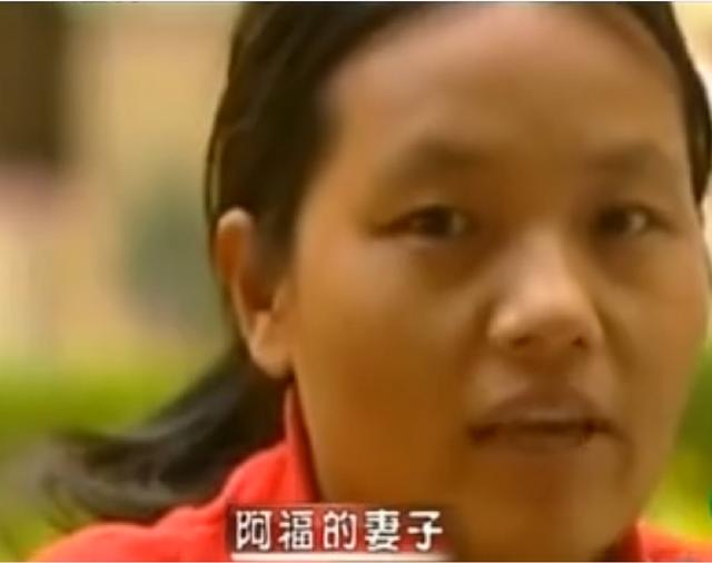 11年云南男子头疼呕吐，身上散发臭味，检查发现脑中插着一把匕首