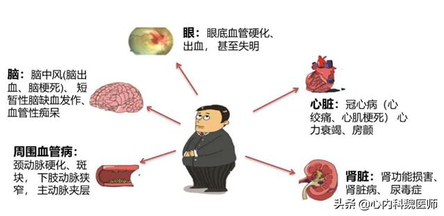男子吃降压药10年，发生肾衰竭！医生：他犯了3个错误，值得反思