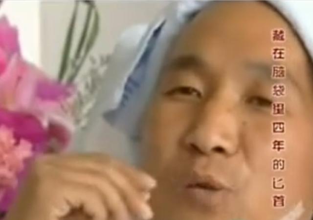 11年云南男子头疼呕吐，身上散发臭味，检查发现脑中插着一把匕首