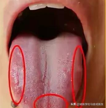 一吃凉的就胃痛？教你几个中成药，让你冷热酸甜，想吃就吃