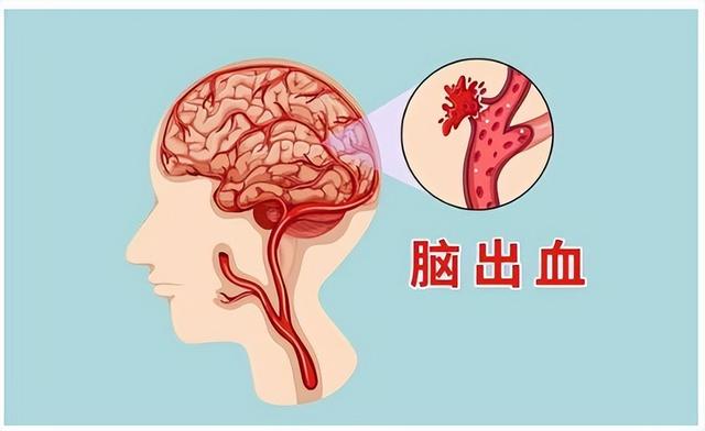 高血压难降，身体熬不住！教你降压五字诀，可以受益终身