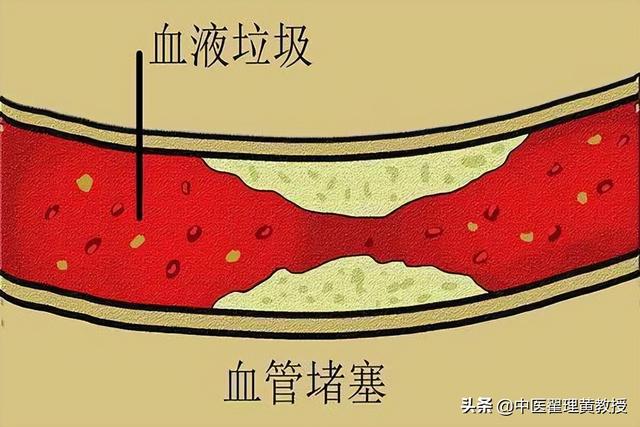 几种助于清理血管的食物，每天吃一点，让你离血栓更远一步