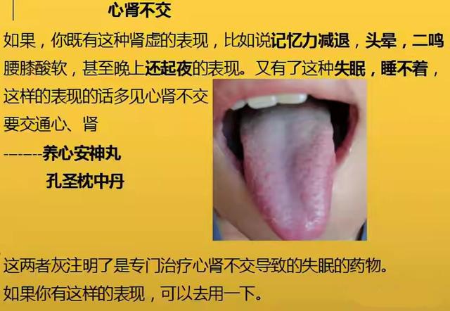凌晨1—3点早醒，8种常见失眠类型，症状表现及实用中成药大总结