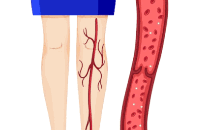 走路腿疼，走走又停停，警惕是这种病