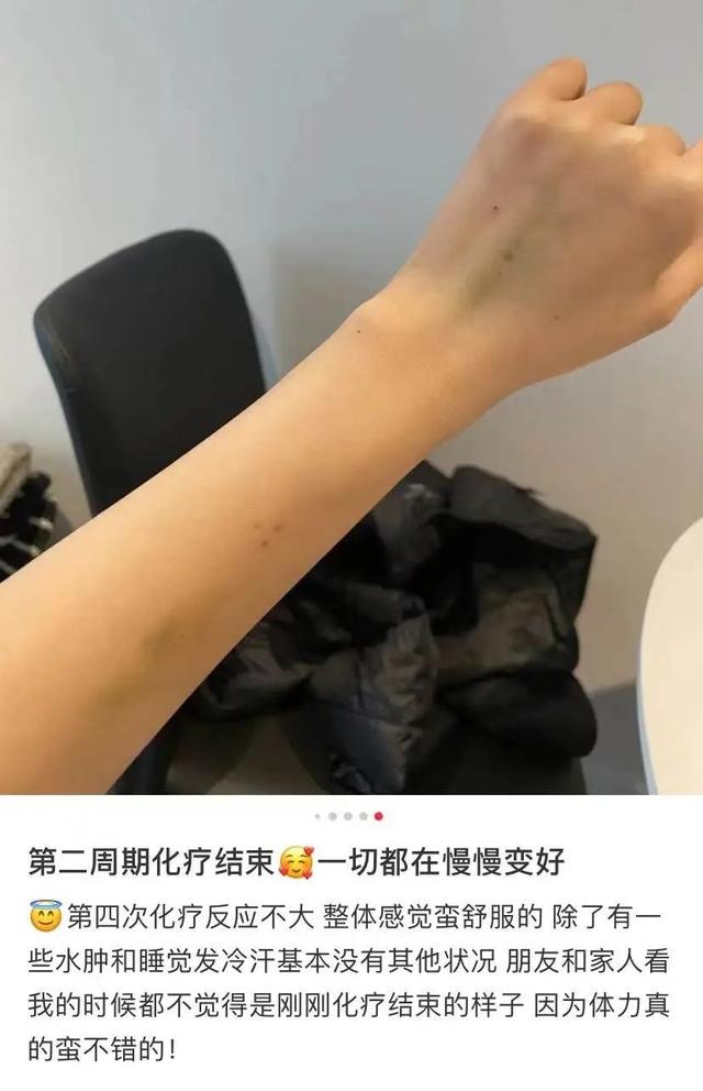 那个被下病危通知书的留学女孩