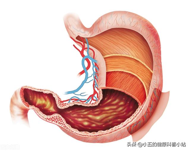 得了慢性萎缩性胃炎不可怕，科学使用4类药物，积极预防病情发展