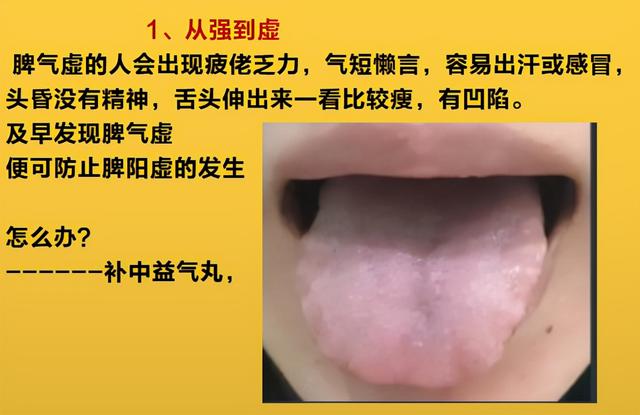 人体从虚-寒-湿-滞-瘀-瘤，仅仅经历了6个阶段，看看你在哪个阶段