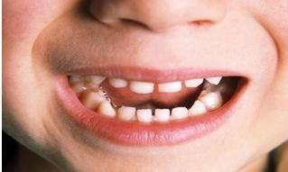 ​孙俪一招吓得孩子乖乖刷牙，获全网10w赞