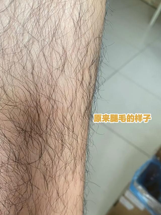 《如何去腿毛男生（男生去腿毛最有效的方法）》