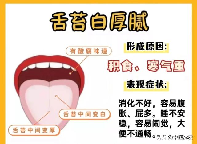 中医：从舌头看健康，舌象分析，常见的6种舌苔问题！和调理建议