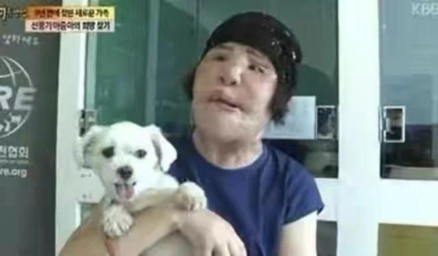 韩慧景：把自己整成“电风扇”，注射食用油代价惨痛，我悔不当初
