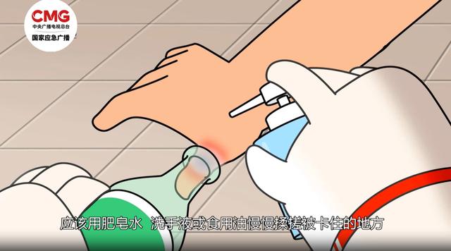 提醒！廚房這個地方利如刀片，千萬不要伸手進去→ - 