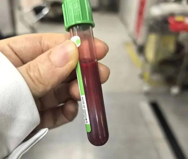 “快生了吃點好的沒關係”，女子孕35周狂吃炸雞漢堡，一周胖10斤，擠出“草莓牛奶”血，母嬰雙雙進ICU