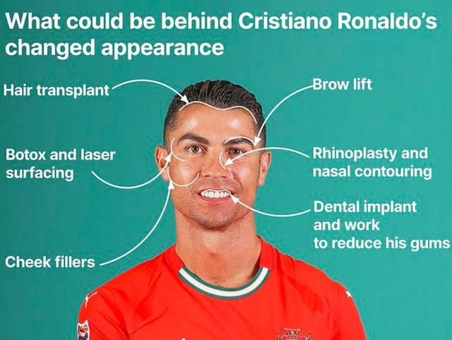 巨星被爆料多次整容，22年內曾經整牙、隆鼻、植髮……團隊暫無回應 - 