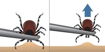 警惕！春日踏青需防範蜱蟲 - 