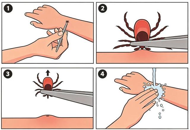 出遊警惕這種小蟲子！出現這種情況，請一定要告訴醫生 - 