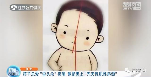 孩子总爱“歪头杀”卖萌？小心！可能是得了这种病