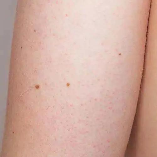 涂了能白的身体乳
