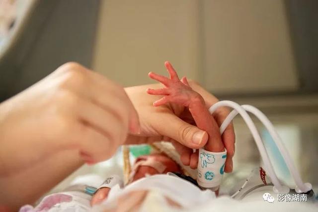 世界早产儿日不用怕，早到的天使