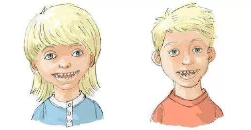 14岁男孩特别爱笑，原来是患上罕见病“天使综合征”