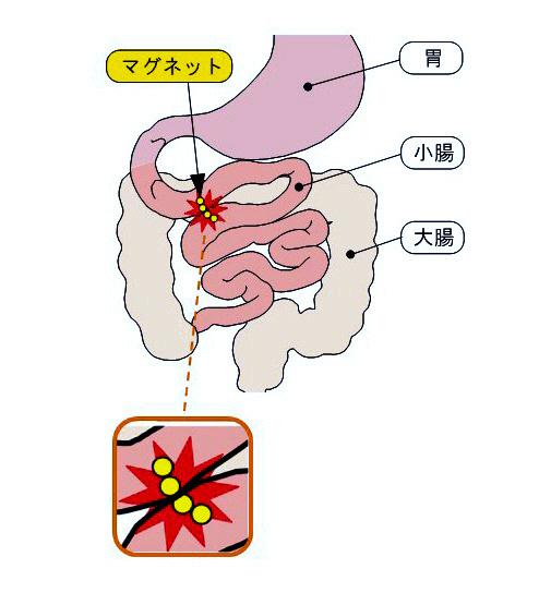 误食事故频发！日本儿童科学会呼吁幼儿远离这类玩具