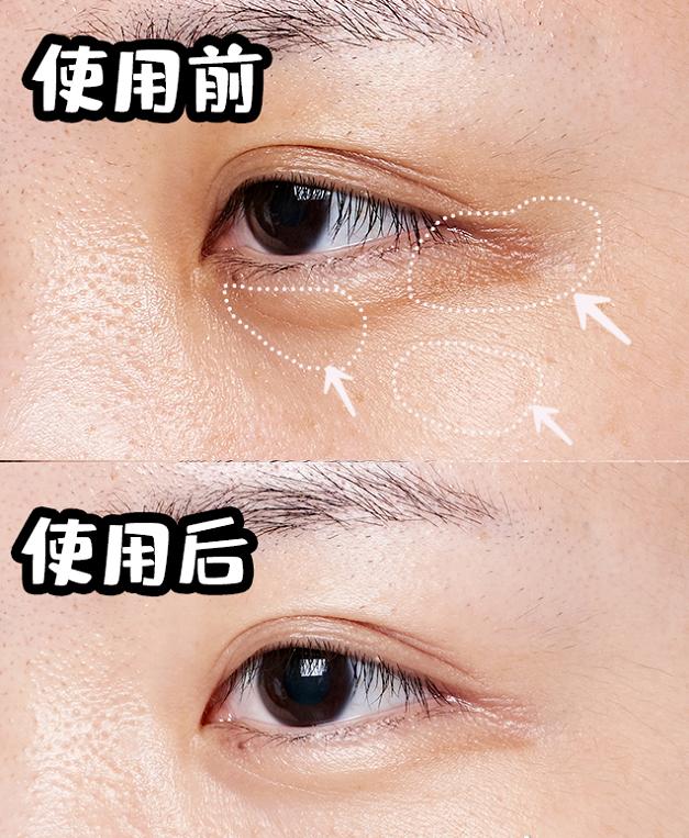lancome眼霜 lancome眼霜