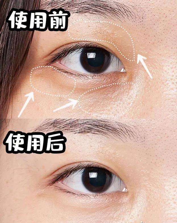 lancome眼霜 lancome眼霜