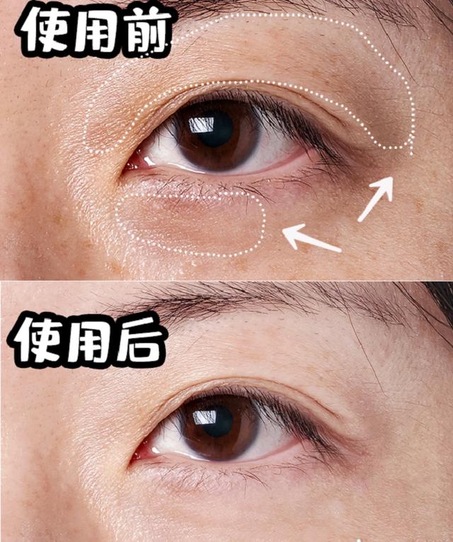 lancome眼霜 lancome眼霜